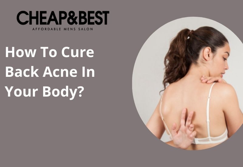 Cure Back Acne